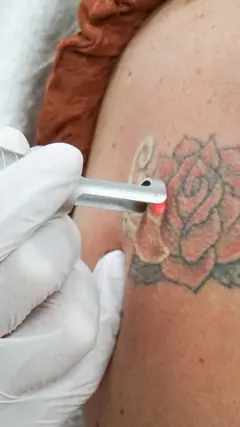 Tattoo poll 2.png